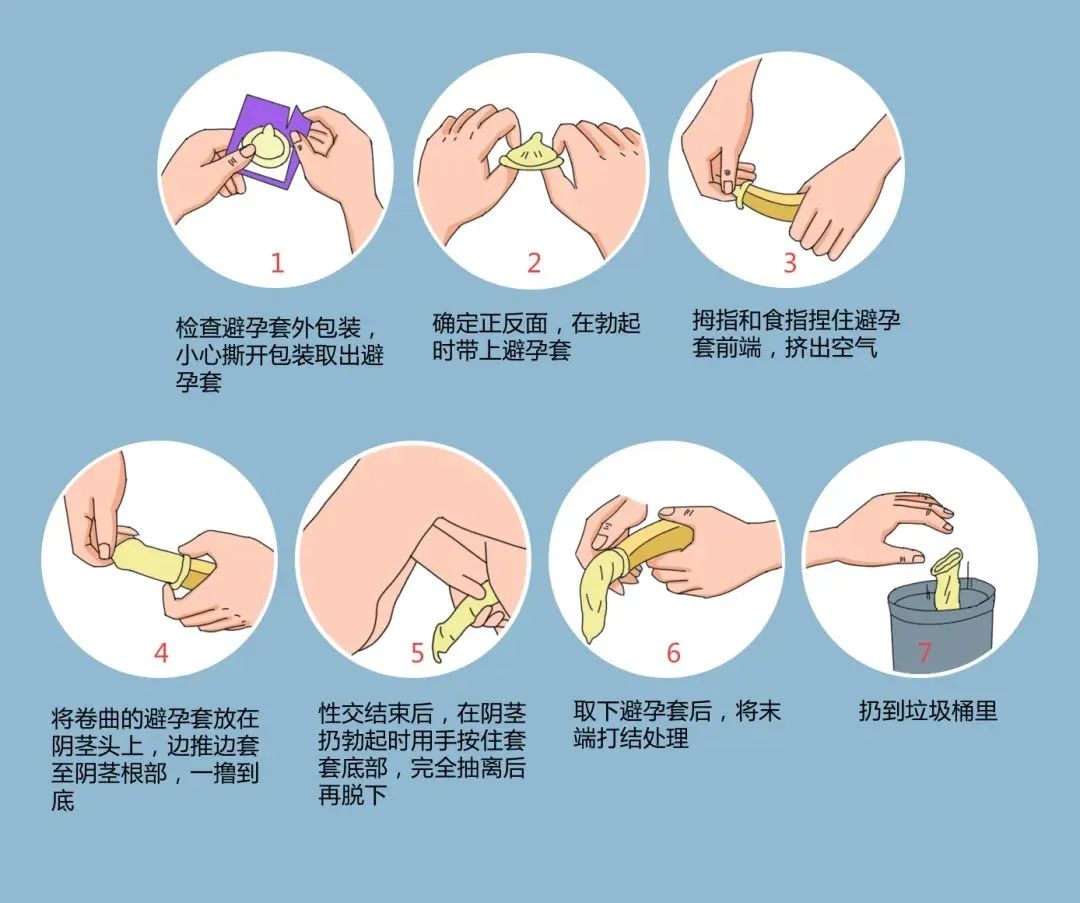 年輕人成艾滋病重災(zāi)區(qū)，正確戴套很有必要.jpg